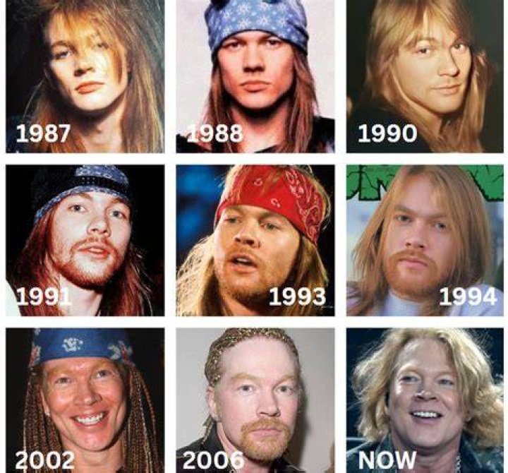Axl Rose from Face Changes That Shocked the World E! News