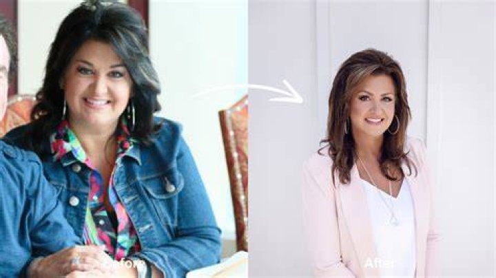Joni Lamb's Path To Weight Loss Surgery